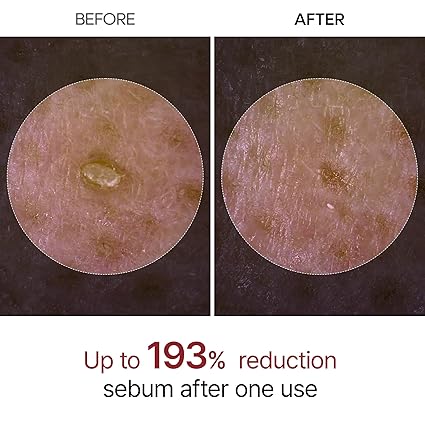 Peel Shot Glow Rice Peeling Ampoule